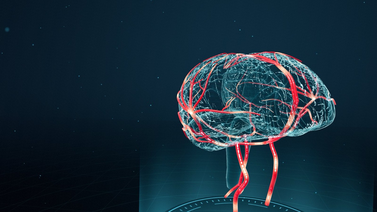 Cérebro em 3D com as artérias em destaque, do treinamento de AVC do IF Simula
